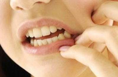 突發(fā)性、自發(fā)性的劇烈牙疼