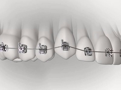 承德市哪家口腔醫(yī)院口腔正畸做得好？惟德口腔醫(yī)院來告訴您