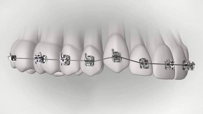 承德市哪家口腔醫(yī)院口腔正畸做得好？惟德口腔醫(yī)院來告訴您